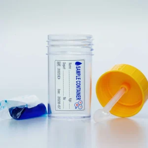 Alternative view of LỌ XÉT NGHIỆM NẮP VÀNG HTM