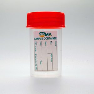 LỌ NẮP ĐỎ, VÀNG, TRẮNG XÉT NGHIỆM HTM